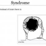 x syndrome