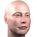 Elon musk bald