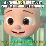 This is happening and it still won't come off. :'( | WHEN YOU TRY TO GET A HANGNAIL OFF BUT IT JUST PULLS MORE AND HURTS WORSE | image tagged in you just experienced an ouchie boo boo | made w/ Imgflip meme maker