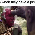 m e n | boys when they have a pimple | image tagged in thanos x vision,pimple,memes,boys vs girls | made w/ Imgflip meme maker