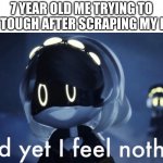 (INTERNAL PAIN) | 7 YEAR OLD ME TRYING TO ACT TOUGH AFTER SCRAPING MY KNEE | image tagged in murder drones v and yet i feel nothing | made w/ Imgflip meme maker