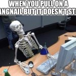 Skeleton at desk/computer/work | WHEN YOU PULL ON A HANGNAIL BUT IT DOESN’T STOP | image tagged in skeleton at desk/computer/work | made w/ Imgflip meme maker