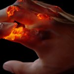 burning hand