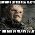 Madonna Plastic Surgery | MADONNA SHOWING OFF HER NEW PLASTIC SURGERY; "THE AGE OF MEN IS OVER" | image tagged in age of men,lotr,lord of the rings,plastic surgery,madonna | made w/ Imgflip meme maker