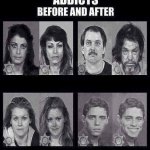 Addicts before after