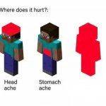 Where does it hurt but in minecraft