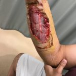 Someone’s arm