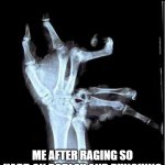 Good news: I didn't break my arm :) | ME AFTER RAGING SO HARD ON ROBLOX AND PUNCHING MY PC AS HARD AS I COULD | image tagged in broken hand | made w/ Imgflip meme maker