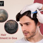 PRP Hair Treatment in Goa - Anew