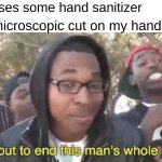 Why tho | Me: Uses some hand sanitizer; That microscopic cut on my hand: | image tagged in i m about to end this man s whole career,relatable,memes,funny,bruh,why | made w/ Imgflip meme maker