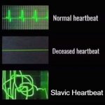 heartbeat rate | Slavic Heartbeat | image tagged in heartbeat rate,slavic | made w/ Imgflip meme maker