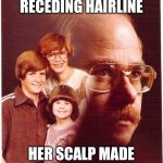 Vengeance Dad | SHE MOCKED MY RECEDING HAIRLINE; HER SCALP MADE A GREAT HAIRPIECE | image tagged in memes,vengeance dad | made w/ Imgflip meme maker