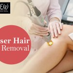 Best Laser Hair Removal in Bangalore: Anew