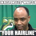 What's up? Your hairline! | ME IN RESPONSE TO "WHAT'S UP?"; "YOUR HAIRLINE" | image tagged in no hairline,memes,funny | made w/ Imgflip meme maker