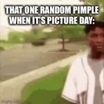 Literally happened to me today ;( | THAT ONE RANDOM PIMPLE WHEN IT’S PICTURE DAY: | image tagged in gifs,hello there | made w/ Imgflip video-to-gif maker