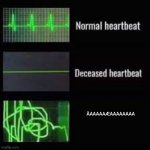 Reaaaaaaaaaaa | ÀAAAAAÆAAAAAAAA | image tagged in heart rate monitor | made w/ Imgflip meme maker