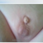 Micro-Dick