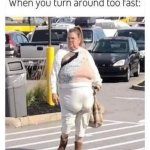 Reverse Butt Syndrome