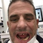 Hunter Biden Crack Teeth template