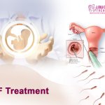 Lowcostivftreatment