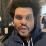 Weeknd Plastic Surgery Stare