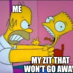 Zit won't leave | ME; MY ZIT THAT WON'T GO AWAY | image tagged in homer strangling bart | made w/ Imgflip meme maker