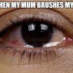 Watery Eyes | ME WHEN MY MUM BRUSHES MY HAIR | image tagged in watery eyes | made w/ Imgflip meme maker