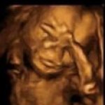 Fetal facepalm