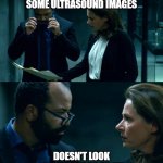 WestWorld: Doesn't look like anything to me | VET SHOWING ME SOME ULTRASOUND IMAGES; DOESN'T LOOK LIKE ANYTHING TO ME | image tagged in westworld doesn't look like anything to me | made w/ Imgflip meme maker