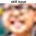 skill issue meme