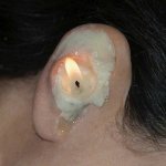 Ear wax meme