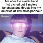 x_x | Me after the elastic band I stretched out 3 meters far snaps and thrusts into my knuckles at 128 miles per hour: | image tagged in fidget spinner | made w/ Imgflip meme maker