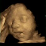 fetus rizz meme