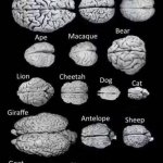 Brain comparison