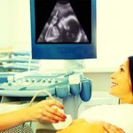 ultrasound baby FJB