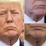 Trump neck