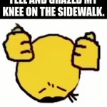 ....... | 5 Y/O ME WHEN I FELL AND GRAZED MY KNEE ON THE SIDEWALK. | image tagged in gifs,sad,so true memes,relatable memes,memes,meme | made w/ Imgflip video-to-gif maker