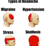 That one type of headache | Skulliosis | image tagged in headaches,funny,funny memes,i spelt scoliosis wrong,haha | made w/ Imgflip meme maker