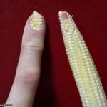 Corn nail