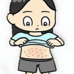 girl with eczema
