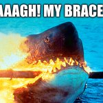 It tingles a bit | AAAAGH! MY BRACES! | image tagged in jaws,great white shark,memes,electricity,braces,fire | made w/ Imgflip meme maker