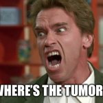 Tumor | WHERE’S THE TUMOR? | image tagged in arnold schwarzenegger screaming kindergarten cop | made w/ Imgflip meme maker