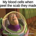 Blood sad :( | My blood cells when I peel the scab they made: | image tagged in years of academy training wasted | made w/ Imgflip meme maker