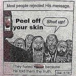 Peel off your skin