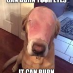 Badly Burned Dog | IF THE ECLIPSE CAN BURN YOUR EYES; IT CAN BURN THEIR EYES | image tagged in poor baby,ham dog,one like one prayer,one share 10 prayers,eclipse,solar eclipse | made w/ Imgflip meme maker