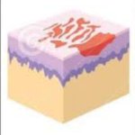 Anatomy of graze