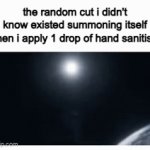 surprise motherfu- | the random cut i didn't know existed summoning itself when i apply 1 drop of hand sanitiser | image tagged in gifs,injury,hand sanitiser,pain | made w/ Imgflip video-to-gif maker