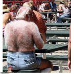 Bernie Sanders hairy back