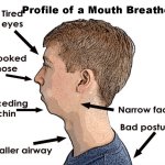 Profile of a Mouth Breather