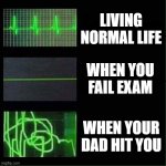 Beat changes | LIVING NORMAL LIFE; WHEN YOU FAIL EXAM; WHEN YOUR DAD HIT YOU | image tagged in heart beat meme | made w/ Imgflip meme maker